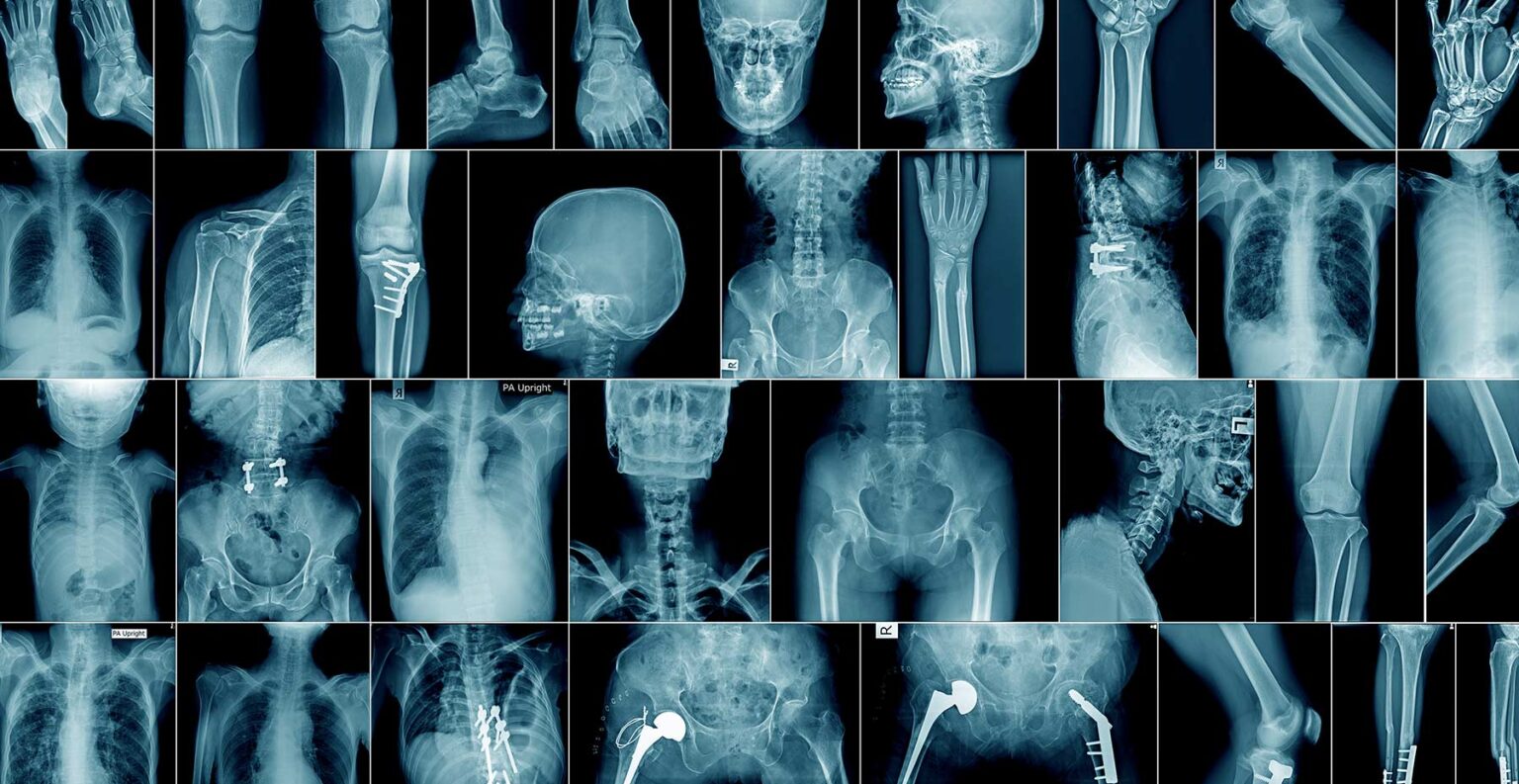 Personal Injury lawyers