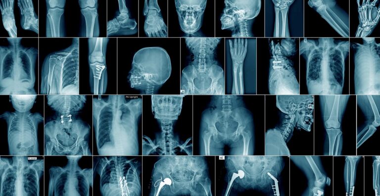 Personal Injury lawyers